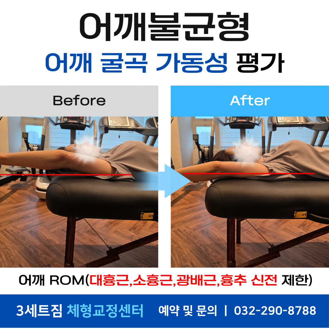 어깨불균형 · 어깨 굴곡 가동성 평가 비포애프터